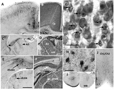 Estimates of total neuron number show that neonatal ethanol causes immediate and lasting neuron loss in cortical and subcortical areas